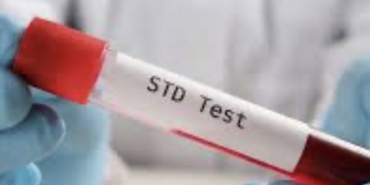 “치료 못해 더 퍼진다”…앨라배마 매독 급증, 최악 상황 오나