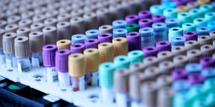 “피 한 방울이면 대장암 검사?”…美 의료계, 새 검사법 공식 인정