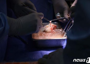 돼지 신장, 사람 몸에 이식한다