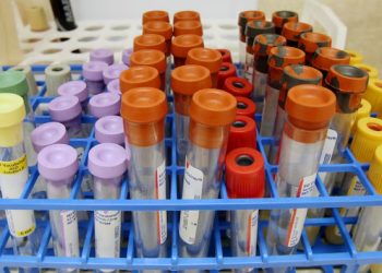 버밍엄 떠나는 제약사…47명 일자리 사라진다