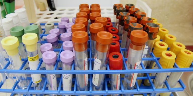 버밍엄 떠나는 제약사…47명 일자리 사라진다